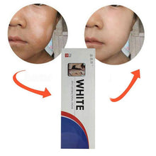 Load image into Gallery viewer, 20g Chinese Medical White Spot Disease Cream Pigment Melanin Promoting Liniment Skin Vitiligo Leukoplakia Disease Treatment